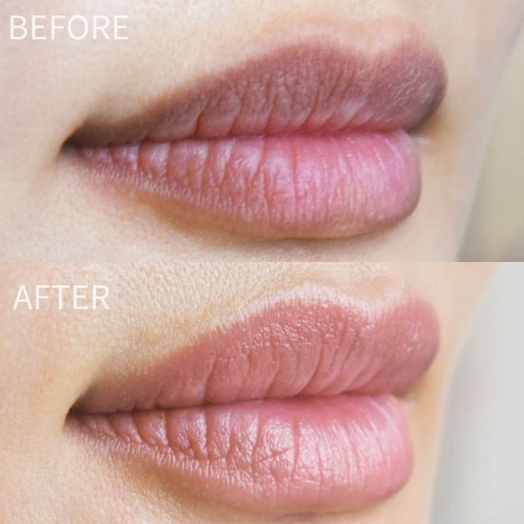 darklip