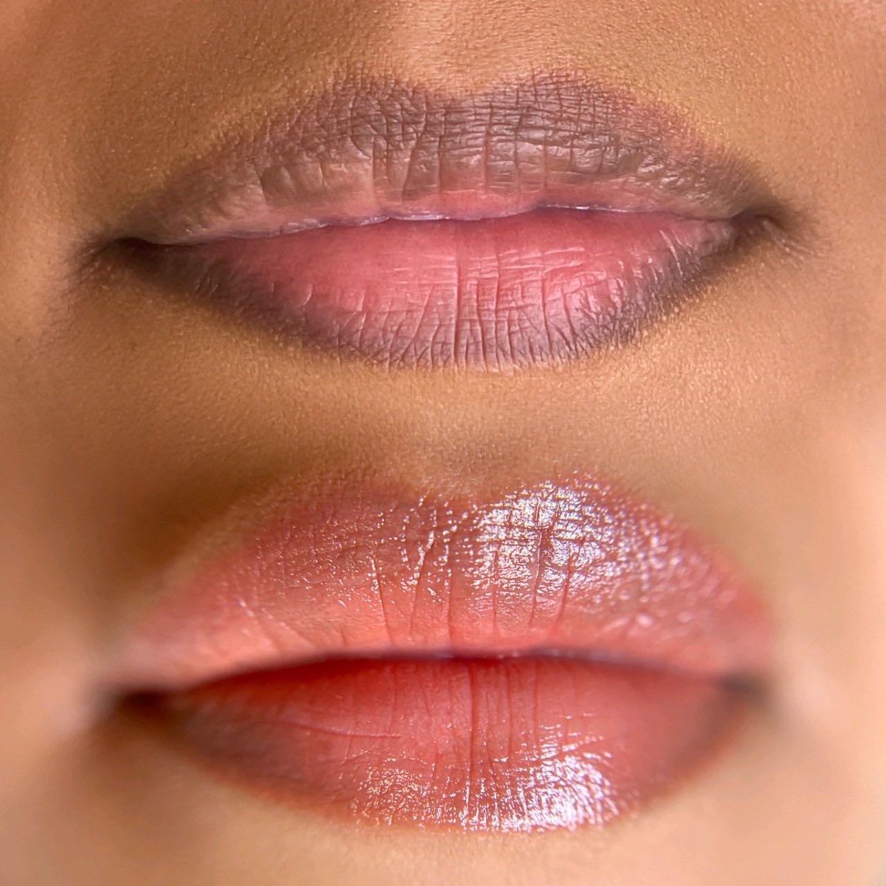 lip-netrulization
