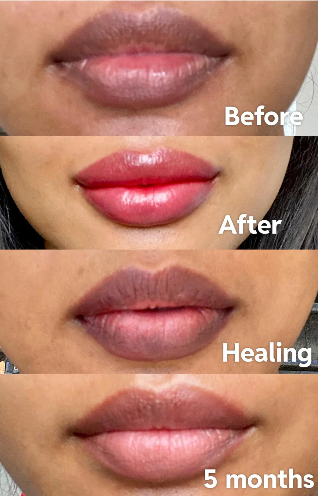 lip-why-choose